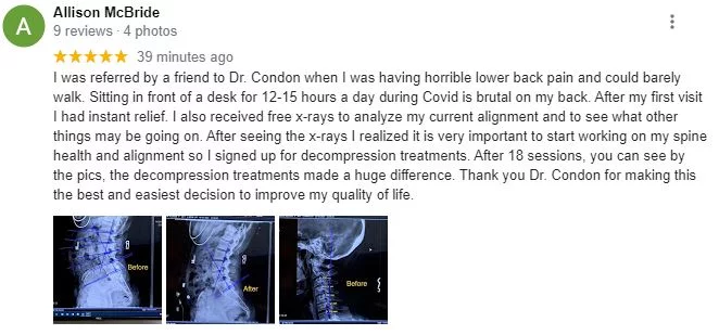 Chiropractor North Scottsdale AZ Ally Spine Center Patient Testimonial