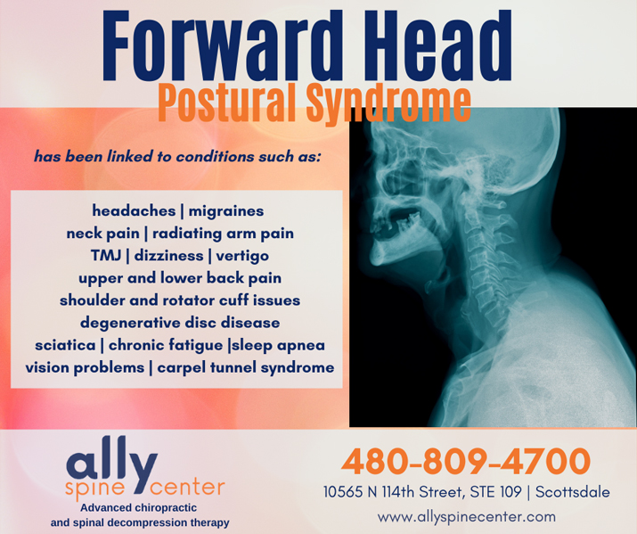 Chiropractic Scottsdale AZ Forward Head Syndrome